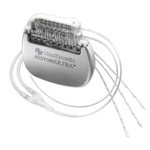 Neuroestimulador Restore™ Ultra | Medtronic